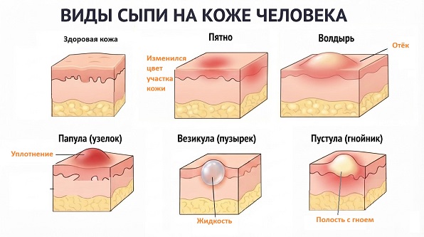 Виды поражения кожи и подкожной клетчатки неуточненного